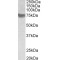 Protein TRC8 Homolog (TRC8) Antibody