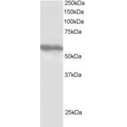 abx433409 staining (1 µg/ml) of HepG2 lysate (RIPA buffer, 30 µg total protein per lane). Primary incubated for 1 hour. Detected by western blot using chemiluminescence.