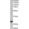 Thyrotropin Receptor (TSHR) Antibody