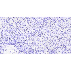 Vav 3 Oncogene (VAV3) Antibody