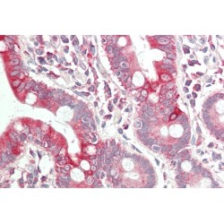 Vascular Endothelial Growth Factor A (VEGFA) Antibody