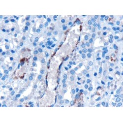 Vacuolar Protein Sorting-Associated Protein 25 (VPS25) Antibody