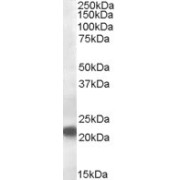 abx433450 (0.5 µg/ml) staining of Rat Kidney lysate (35 µg protein in RIPA buffer). Primary incubation was 1 hour. Detected by chemiluminescence.