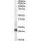 Vacuolar Protein Sorting-Associated Protein 25 (VPS25) Antibody