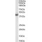 Vacuolar Protein Sorting-Associated Protein 37C (VPS37C) Antibody