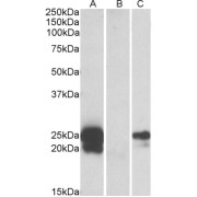 HEK293 lysate (10 µg protein in RIPA buffer) overexpressing Human WFDC2 with C-terminal MYC tag probed with abx433456 (1 µg/ml) in Lane A and probed with anti-MYC Tag (1/1000) in lane C. Mock-transfected HEK293 probed with abx433456 (1mg/ml) in Lane B. Primary incubations were for 1 hour. Detected by chemiluminescence.