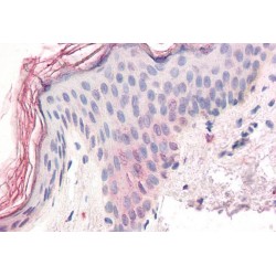 Zic Family Member 5 (ZIC5) Antibody