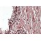 Zinc Finger Protein 217 (ZNF217) Antibody