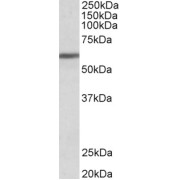 abx433463 (1 µg/ml) staining of Human Breast cancer lysate (35 µg protein in RIPA buffer). Primary incubation was 1 hour. Detected by chemiluminescence.