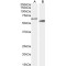 Cytochrome P450 Family 2 Subfamily R Member 1 (CYP2R1) Antibody