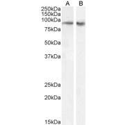 abx433489 (0.1 µg/ml) staining of nuclear HeLa (A) and A431 (B) cell lysate (35 µg protein in RIPA buffer). Detected by chemiluminescence.