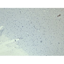 Doublecortex (DCX) Antibody