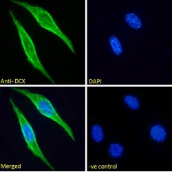 Doublecortex (DCX) Antibody