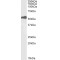 ETS Translocation Variant 4 (ETV4) Antibody