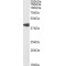 NODAL Antibody