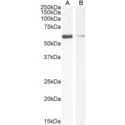 abx433574 (1 µg/ml) staining of HEK293 (A) and HeLa (B) cell lysate (35 µg protein in RIPA buffer). Primary incubation was 1 hour. Detected by chemiluminescence.