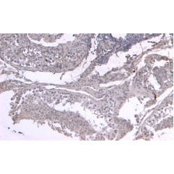 Leukemia Inhibitory Factor (LIF) Antibody