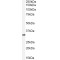 Cathepsin B (CTSB) Antibody