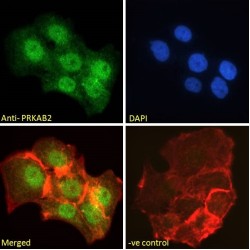 5'-AMP-Activated Protein Kinase Subunit Beta-2 (PRKAB2) Antibody