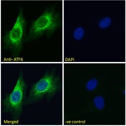 Cyclic AMP-Dependent Transcription Factor ATF-6 Alpha (ATF6) Antibody