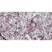 IHC-P analysis of Human spleen tissue, using SH3 Domain Containing Kinase Binding Protein 1 (SH3KBP1) Antibody (2.5 µg/ml).