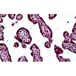 SH3 Domain Containing Kinase Binding Protein 1 (SH3KBP1) Antibody