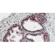 IHC-P analysis of Human prostate tissue, using Sorting Nexin 4 (SNX4) Antibody (3.8 µg/ml).