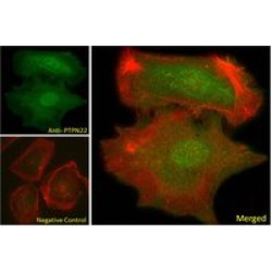 Tyrosine-Protein Phosphatase Non-Receptor Type 22 (PTPN22) Antibody