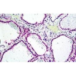 Tyrosine-Protein Phosphatase Non-Receptor Type 22 (PTPN22) Antibody