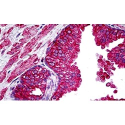 Cystic Fibrosis Transmembrane Conductance Regulator (CFTR) Antibody