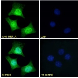 Hepatocyte Nuclear Factor 1 Alpha (HNF1A) Antibody