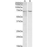 WB analysis of Rat liver (A) and Mouse liver (B) lysates (35 µg protein in RIPA buffer), using Hepatocyte Nuclear Factor 1 Alpha (HNF1A) Antibody (2 µg/ml).