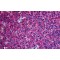 Securin (PTTG1) Antibody