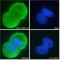 Tumor Necrosis Factor Ligand Superfamily Member 11 / RANKL (TNFSF11) Antibody