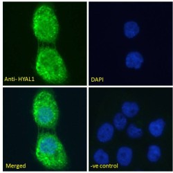 Hyaluronidase 1 (HYAL1) Antibody