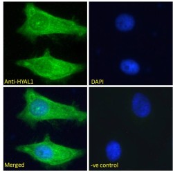 Hyaluronidase 1 (HYAL1) Antibody