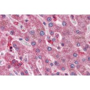 IHC-P analysis of Human liver tissue, using Hyaluronidase 1 (HYAL1) Antibody (5 µg/ml).