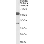 WB analysis of Human liver lysate (35 µg protein in RIPA buffer), using Estrogen Receptor Beta (ESR2) Antibody (2 µg/ml).