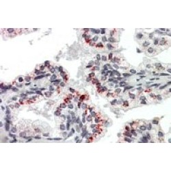 Pleiotrophin (PTN) Antibody