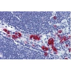 Ras Association Domain Family Member 2 (RASSF2) Antibody