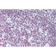 IHC-P analysis of Human tonsil tissue, using Paired Box Protein Pax-7 (PAX7) Antibody (3.8 µg/ml).