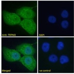 Transient Receptor Potential Cation Channel Subfamily M Member 2 (TRPM2) Antibody