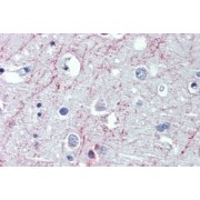 IHC-P analysis of Human cortex tissue, using Gamma-Aminobutyric Acid B Receptor 1 (GABBR1) Antibody (5 µg/ml).