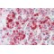 Clathrin Heavy Chain 1 (CLTC) Antibody