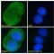 Platelet-Derived Growth Factor Subunit B (PDGFB) Antibody