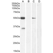 WB analysis of extracts of Human cerebellum (A), peptide (B), NIH3T3 cells (C) and Negative control adrenal gland (D) lysates (35 µg protein in RIPA buffer), using Intermediate Conductance Calcium-Activated Potassium Channel Protein 4 (KCNN4) Antibody (0.1 µg/ml).