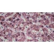 IHC-P analysis of Human liver tissue, using SH3 And PX Domains 2A (SH3PXD2A) Antibody (3.8 µg/ml).