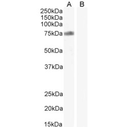 Cytochrome B-245 Heavy Chain (CYBB) Antibody