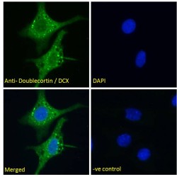 Doublecortin (DCX) Antibody