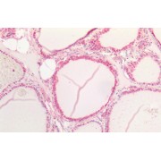 IHC-P analysis of Human thyroid tissue, using Neurogenic Locus Notch Homolog Protein 1 (NOTCH1) Antibody (5 µg/ml).
